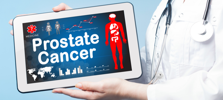 סרטן הערמונית: טיפול קרינתי ללא פגיעה במעי-תמונה